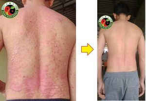 Feedback cập nhật Thịnh Xuân Đường