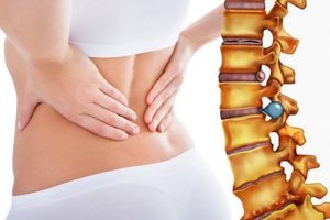 Thoát vị đĩa đệm cột sống